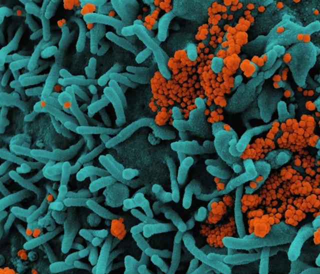 Coloured scanning electron micrograph: orange virus particles on the teal surface of a cell